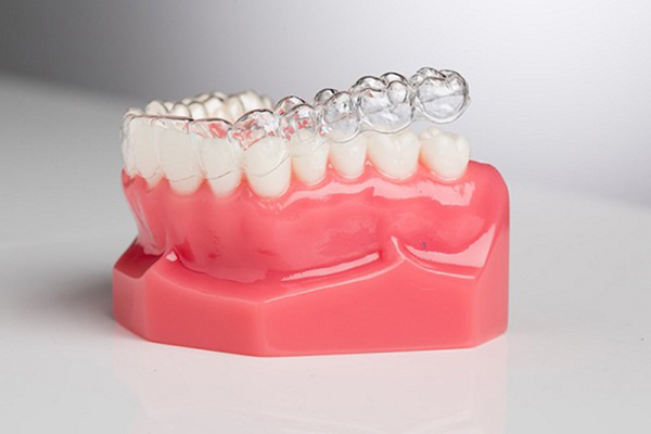 khay niềng ivisalign